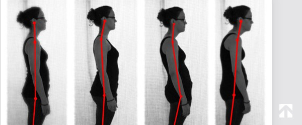 Posture 101: What it looks like - Xdesk Blog